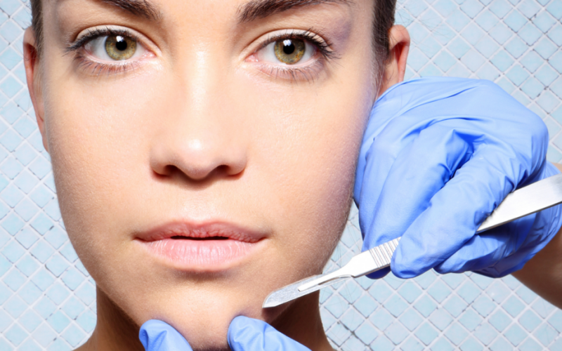 Cirurgia-Dermatologica-1024x576