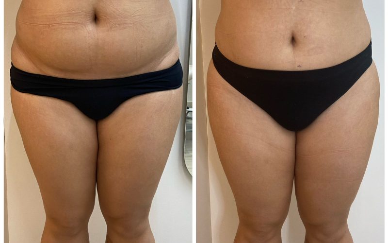 WhatsApp Image 2024-02-24 at 19.12.09