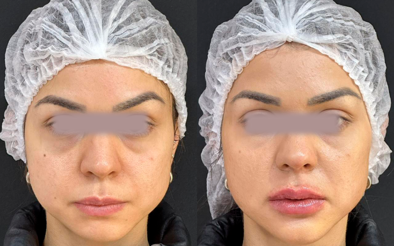 WhatsApp Image 2024-02-28 at 13.39.44 (1)