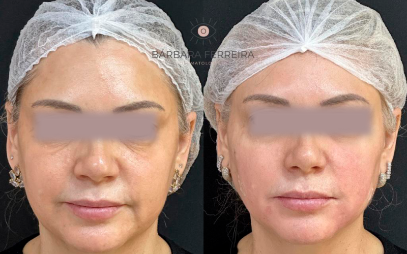 WhatsApp Image 2024-02-28 at 13.39.44 (3)